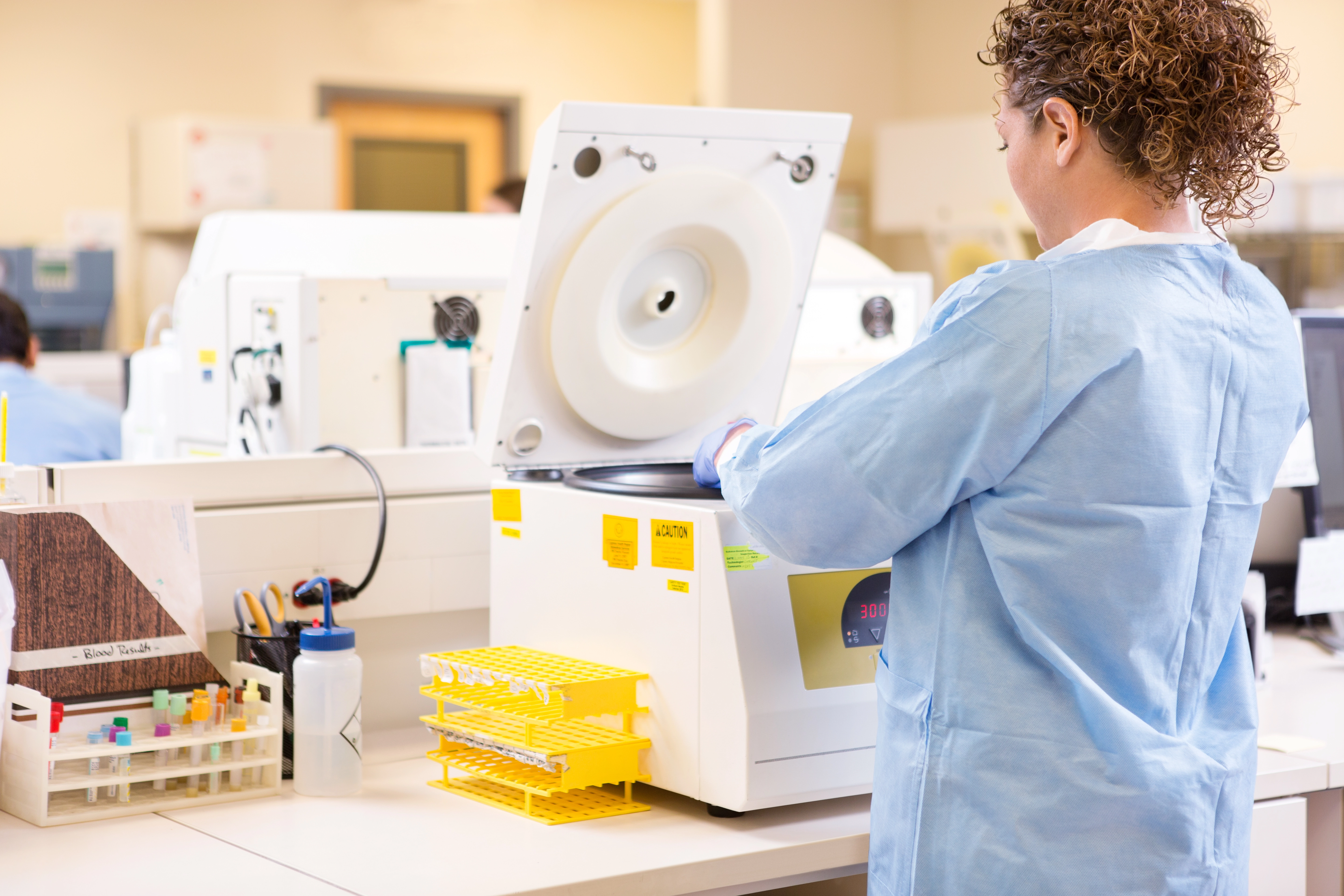 qPCR vs. Digital PCR: Choosing the Right Quantification Method
