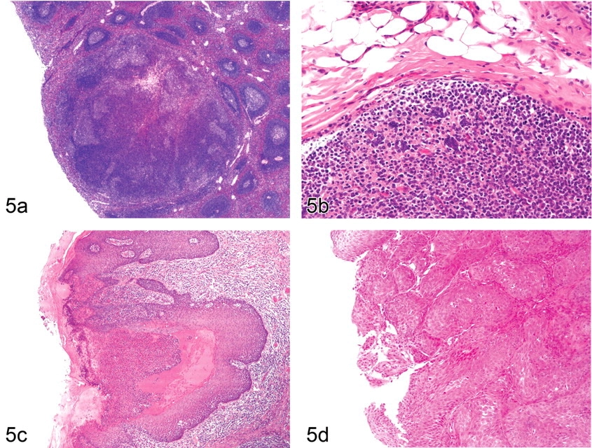 Cynomolgus Monkey Esophagus Tissue