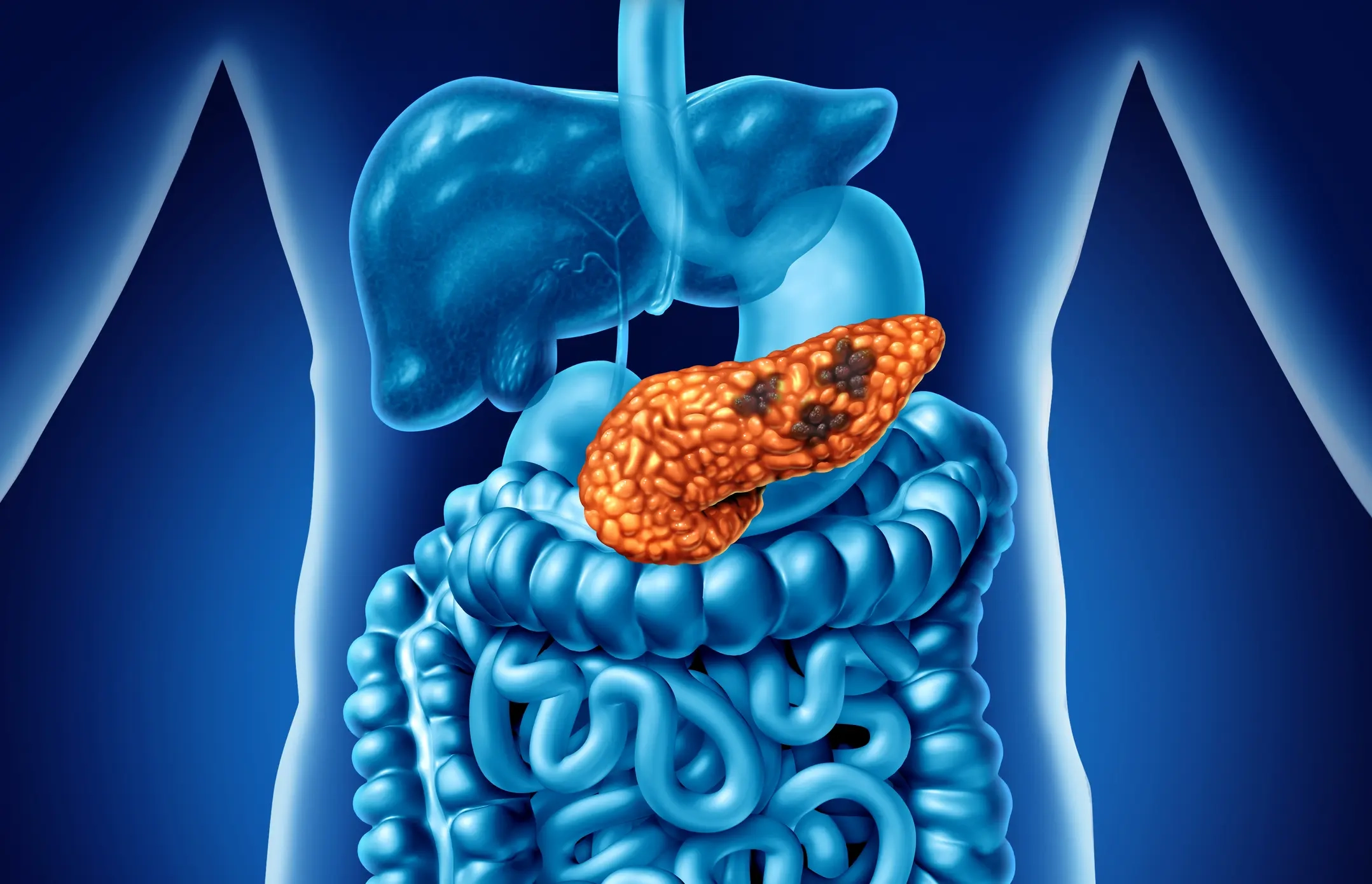 Human Pancreatic Cancer Associated Fibroblast Cells: A Scientific Overview for Tumor Microenvironment Research