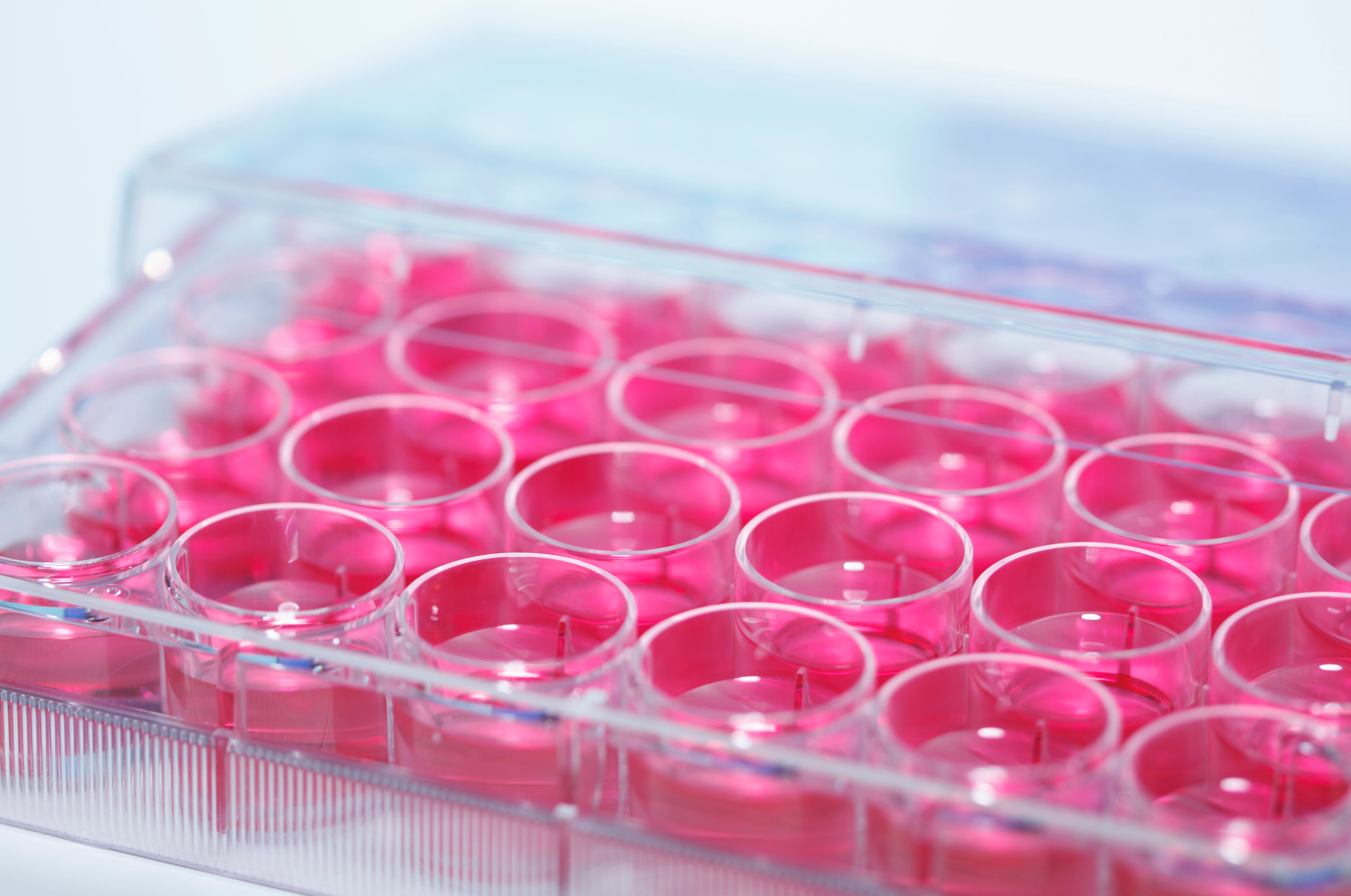 Comment choisir un kit ELISA adapté à son échantillon