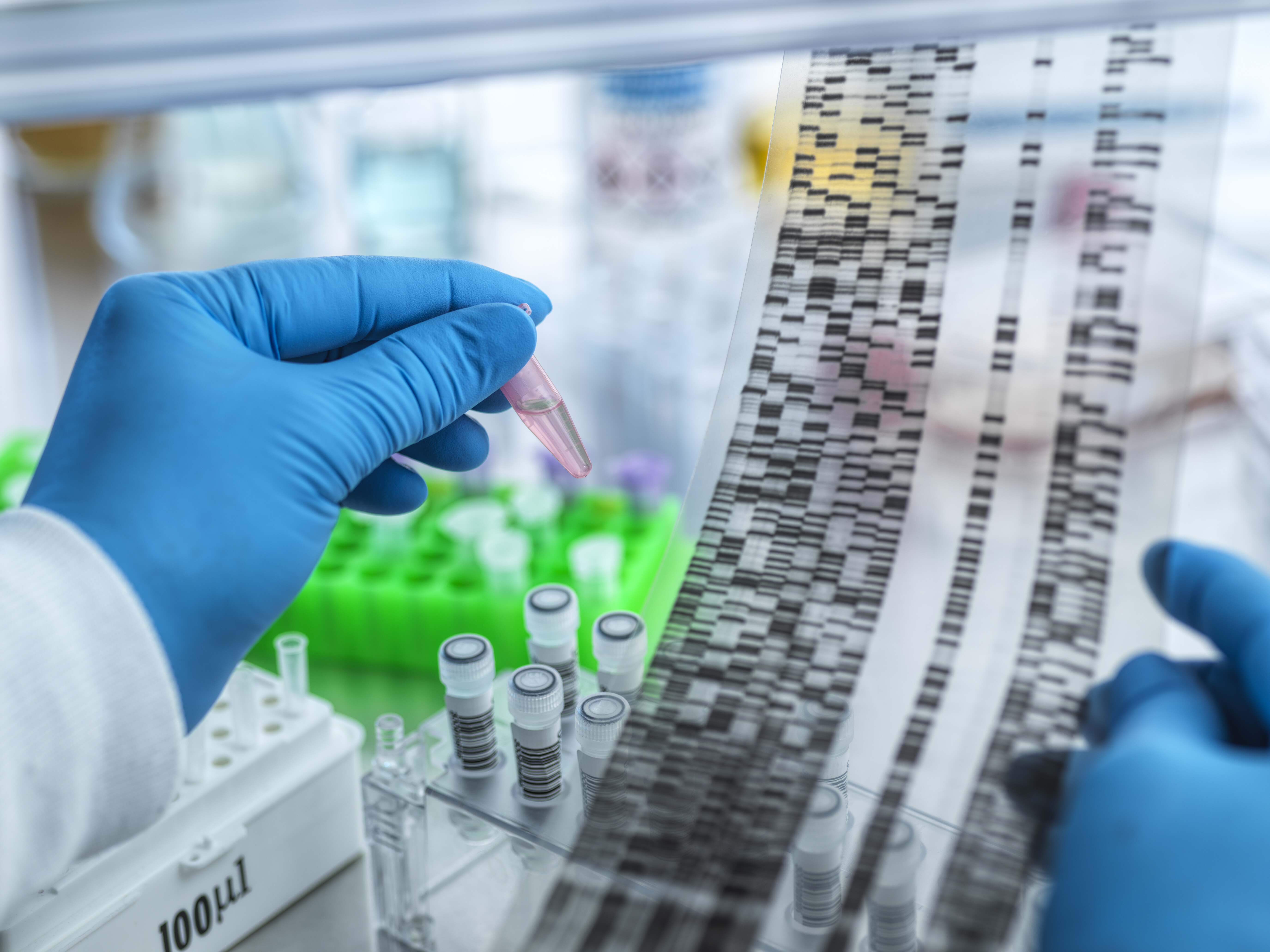 Robust Bacterial scRNA-seq Protocol Developed: A New Chapter in Microbial Transcriptomics