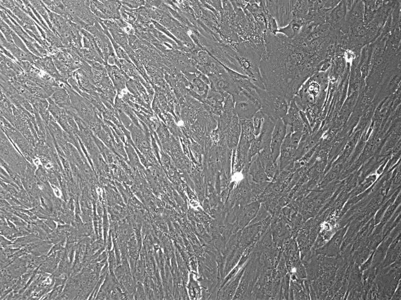 Human Placental Mesenchymal Stem Cells, - image 1
