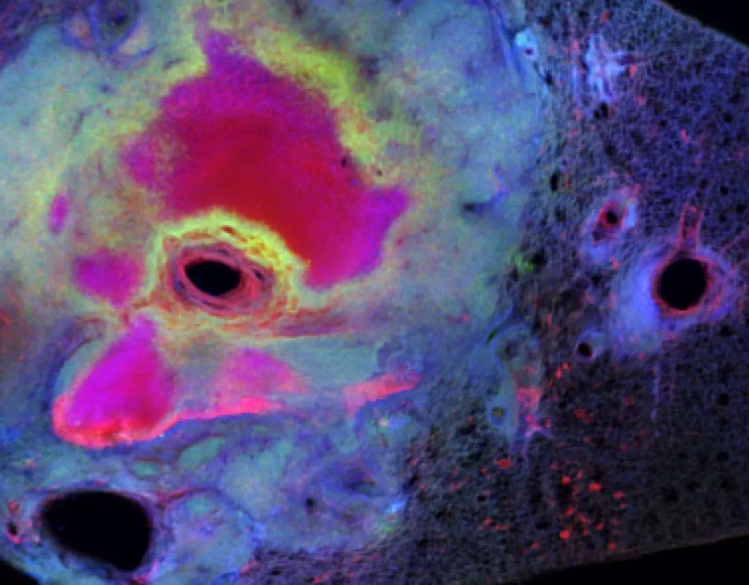 Anti-ICAM-1 (15.2) In Vivo Antibody - Ultra-Low Endotoxin - image 1