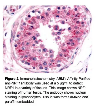 Anti-NRF1 - image 1