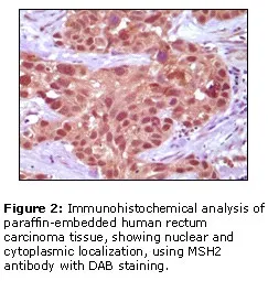 Anti-MSH2 - image 1