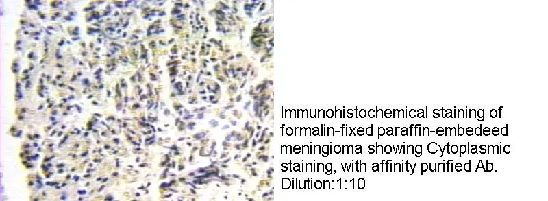 Anti Human RAB6A Polyclonal - image 1