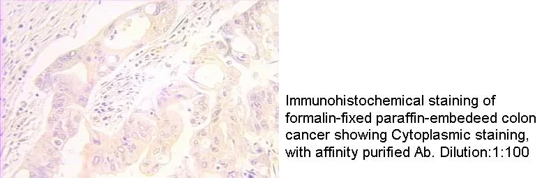 Anti Human CARD14 Polyclonal - image 1
