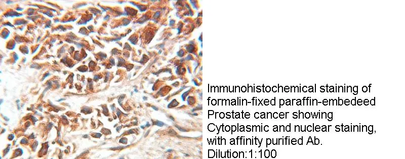 Anti Human EEF1D Polyclonal - image 1