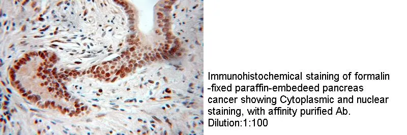 Anti Human PGM2 Polyclonal - image 1