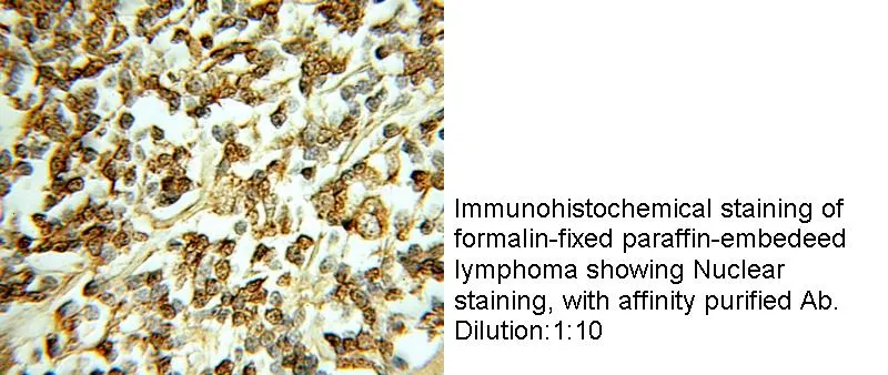Anti Human CDK4 Polyclonal - image 1