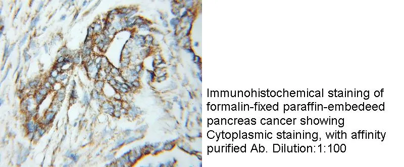 Anti Human TPST2 Polyclonal - image 1