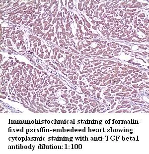 Anti-TGF beta1 - image 1