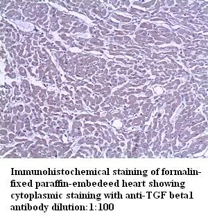 Anti-TGF beta1 - image 1