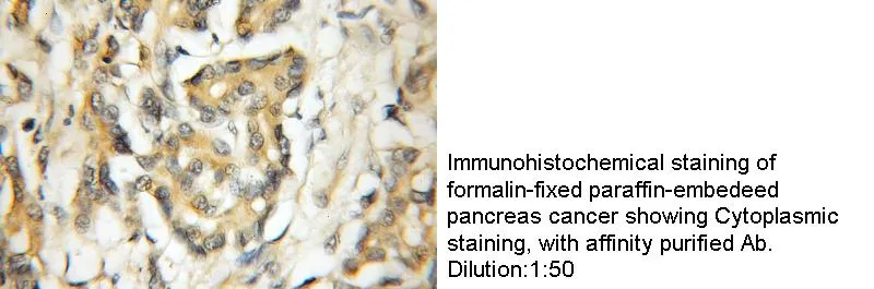 Anti Human RAB2B Polyclonal - image 1