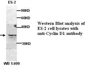 Anti-Cyclin D1 - image 1