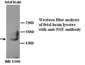 Anti-NSE - image 1