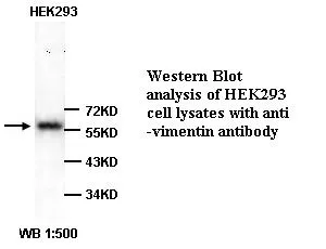 Anti-Vimentin - image 1