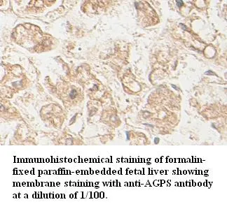 Anti-AGPS - image 1