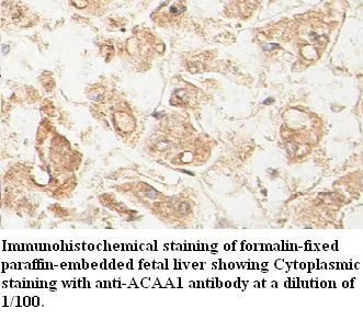 Anti-ACAA1 - image 1