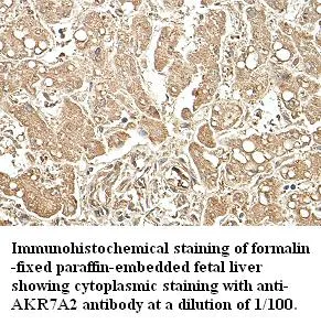 Anti-AKR7A2 - image 1