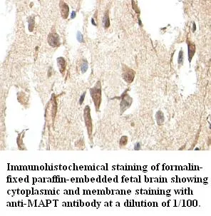 Anti-MAPT - image 1
