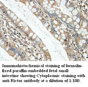 Anti-Rictor - image 1