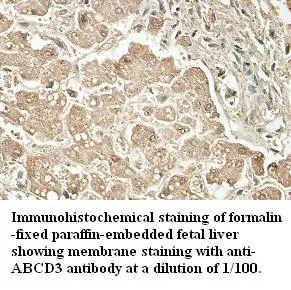 Anti-ABCD3 - image 1