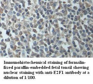 Anti-E2F1 - image 1