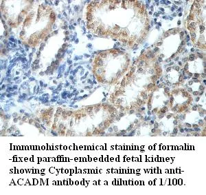 Anti-ACADM - image 1
