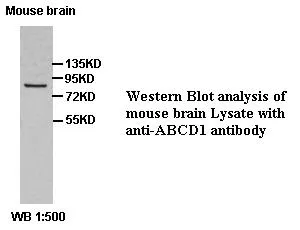 Anti-ABCD1 - image 1
