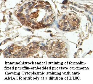 Anti-AMACR - image 1