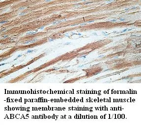 ABCA5 - image 1