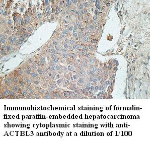 Anti-ACTBL3 - image 1