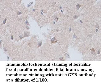 Anti-AGER - image 1