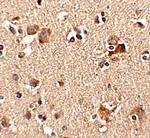 Anti-AIPL1 - image 1