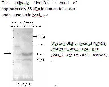 Anti-AKT1 - image 1