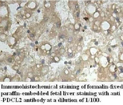 Anti-PDCL2 - image 1