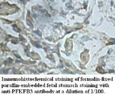 Anti-PFKFB3 - image 1
