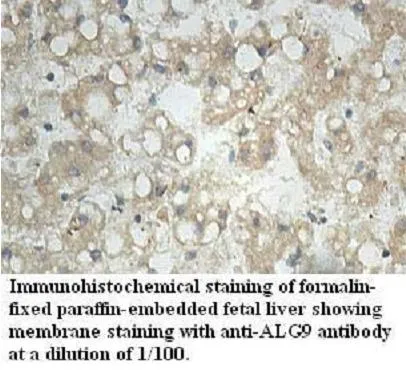 Anti-ALG9 - image 1