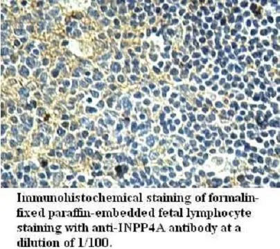 Anti-INPP4A - image 1
