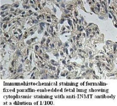 Anti-INMT - image 1