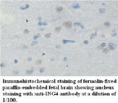 Anti-ING4 - image 1