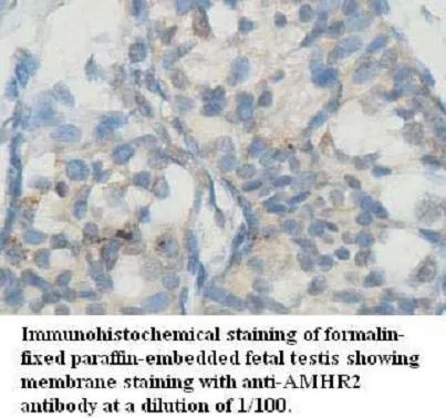 Anti-AMHR2 - image 1