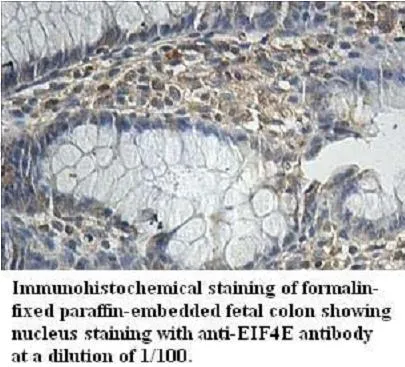 Anti-EIF4E - image 1