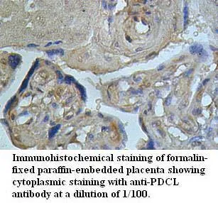 Anti-PDCL - image 1