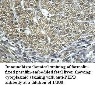 Anti-PEPD - image 1