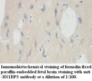 Anti-HS1BP3 - image 1