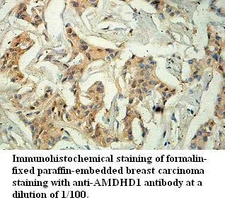 Anti-AMDHD1 - image 1