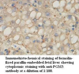 Anti-PGM3 - image 1