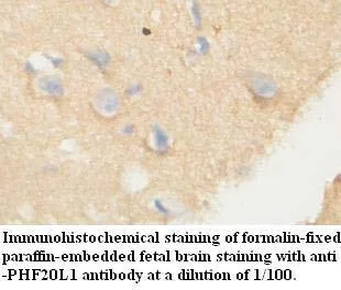 Anti-PHF20L1 - image 1
